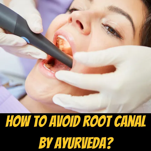 How to avoid root canal by ayurveda?